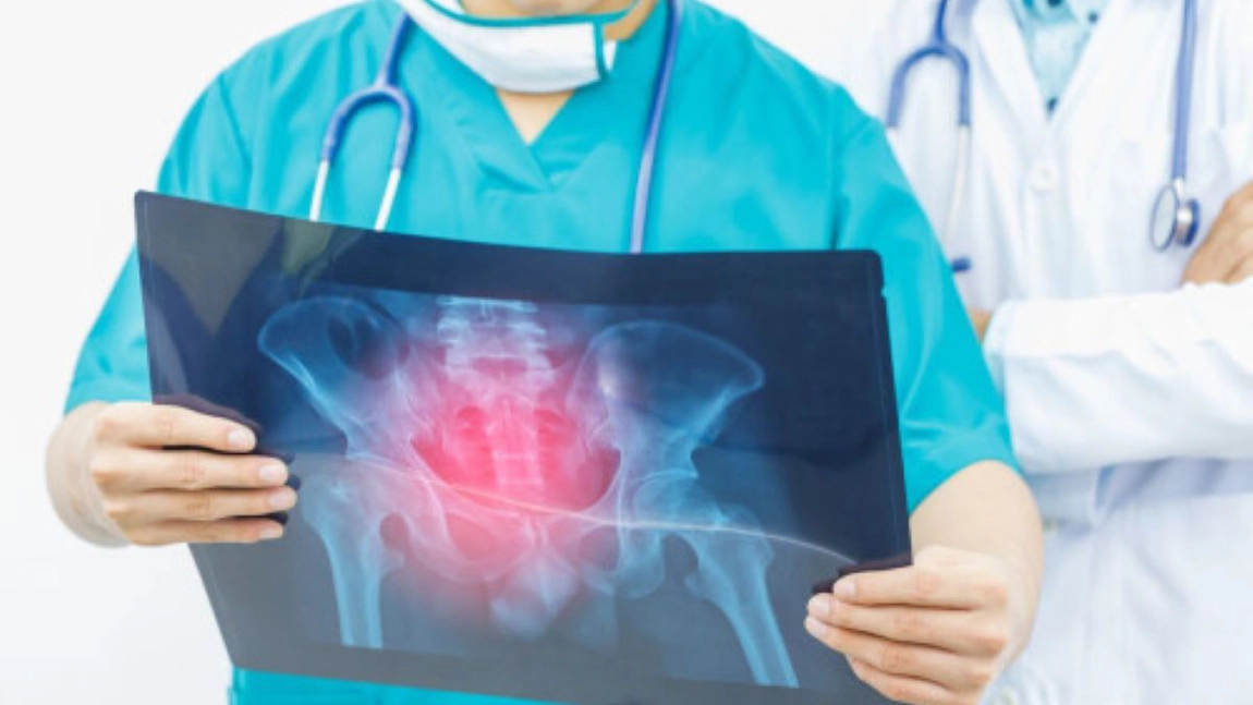 Ce simptome resimți atunci când ai cancer osos? Iată ce analize se fac pentru a depista această boală!