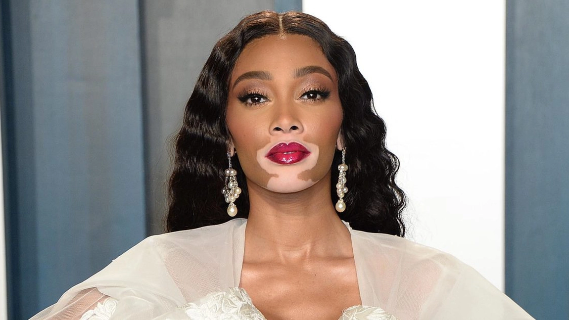 Winnie Harlow postează niște fotografii superbe. Iată cum arată la 31 de ani