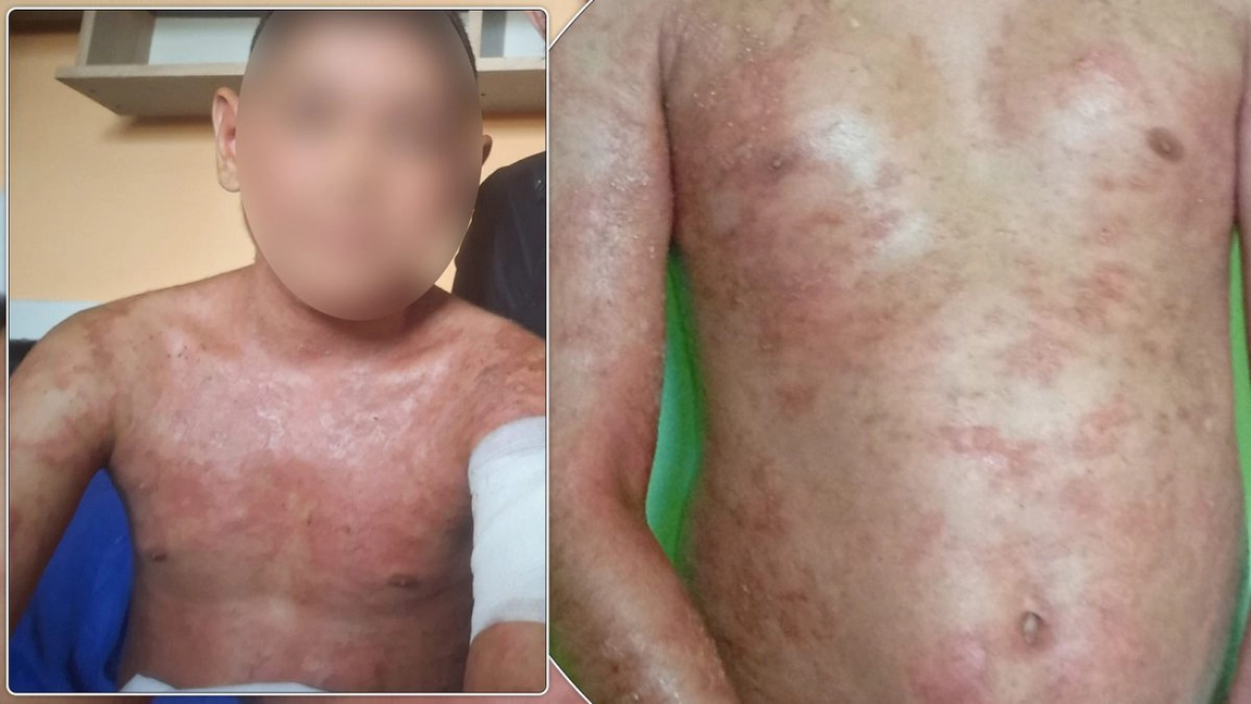 Apel disperat pentru Gabriel, un băiețel de 10 ani din Iași, care se luptă cu o boală cumplită. Familia cere ajutor pentru a-l salva: „Fiecare zi e o suferință pentru el”