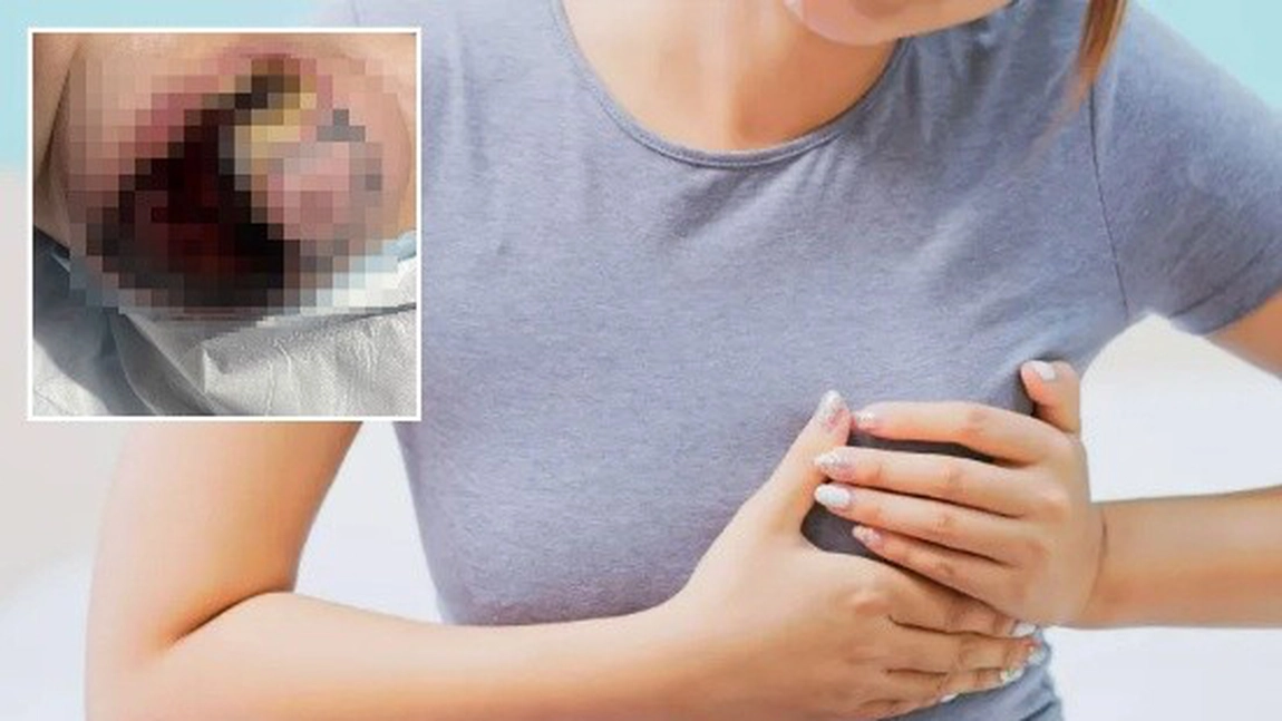 Șocant! O mamă a ajuns de urgență la spital, după ce sânul i s-a înnegrit și a început să se inflameze
