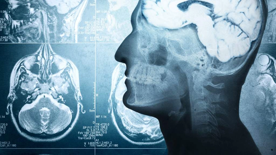 Ce este substanța de contrast? Iată tot ce trebuie să știi despre agentul vizualizator