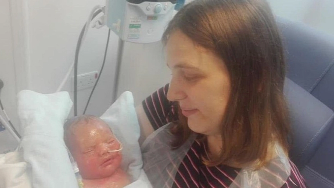 O mamă a adus pe lume un băiețel cu ihtioză congenitală. Medicii au rămas șocați la vederea copilului