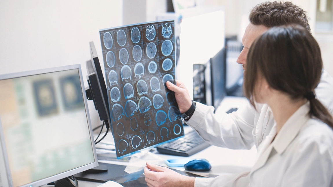 Impactul factorilor genetici și de mediu în dezvoltarea sclerozei multiple