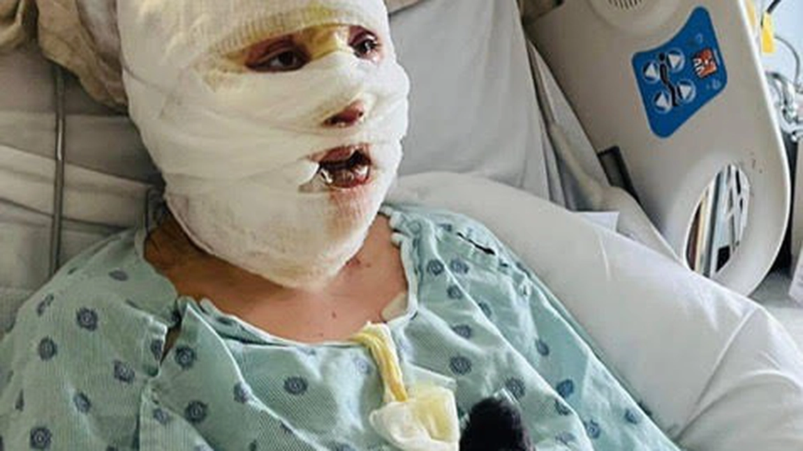 Clipe de coșmar trăite într-o tabără! O tânără a fost cuprinsă de flăcări după ce un prieten a turnat benzină pe foc