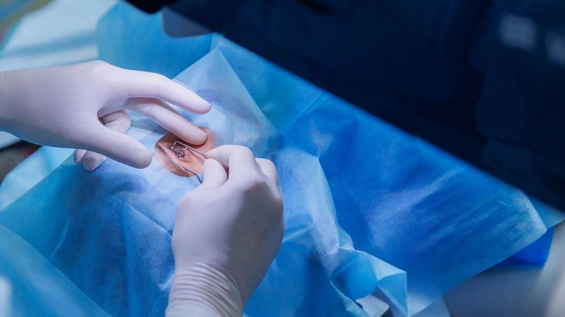 Cum să te pregătești pentru operația de miopie cu laser SMILE PRO?