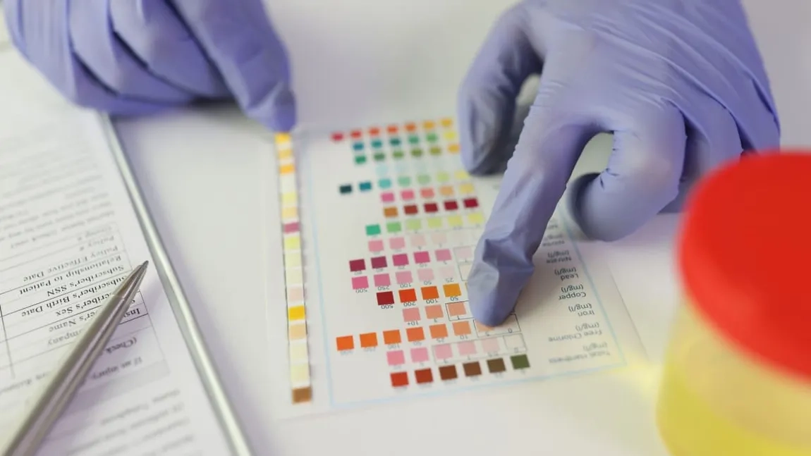 Ce înseamnă faptul că ai acidul ascorbic în urină 20 mg/dL? Iată cum trebuie interpretat acest rezultat și ce trebuie să faci în continuare