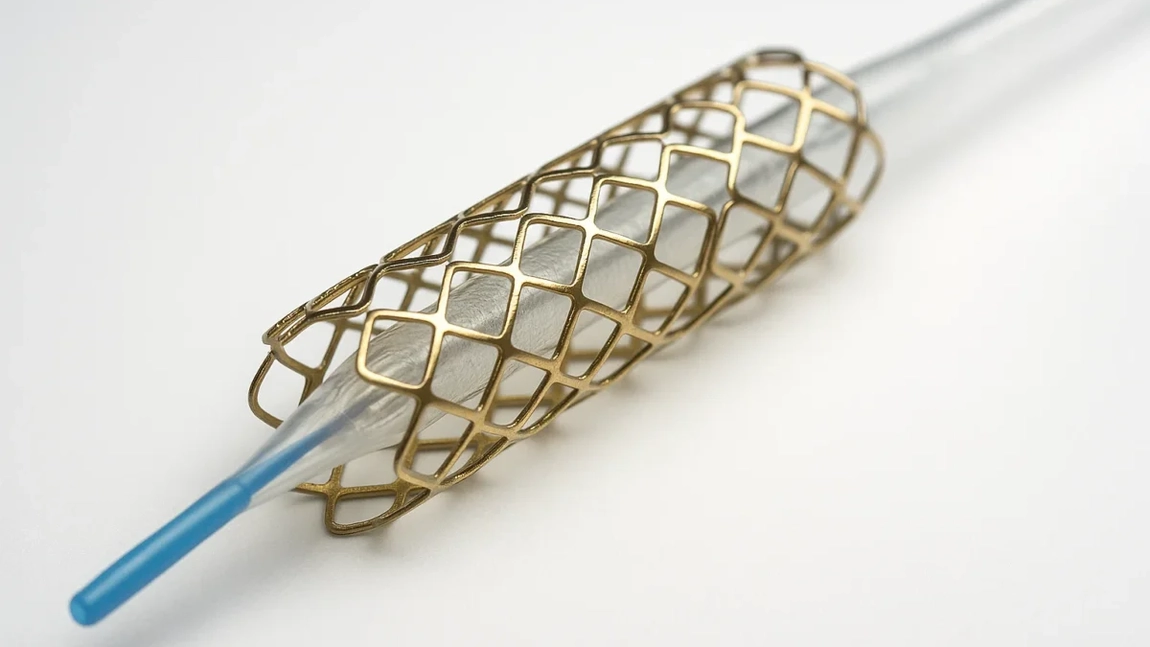 Când se pune stent la inimă? Iată la ce simptome să fii atent și ce trebuie să știi despre această procedură