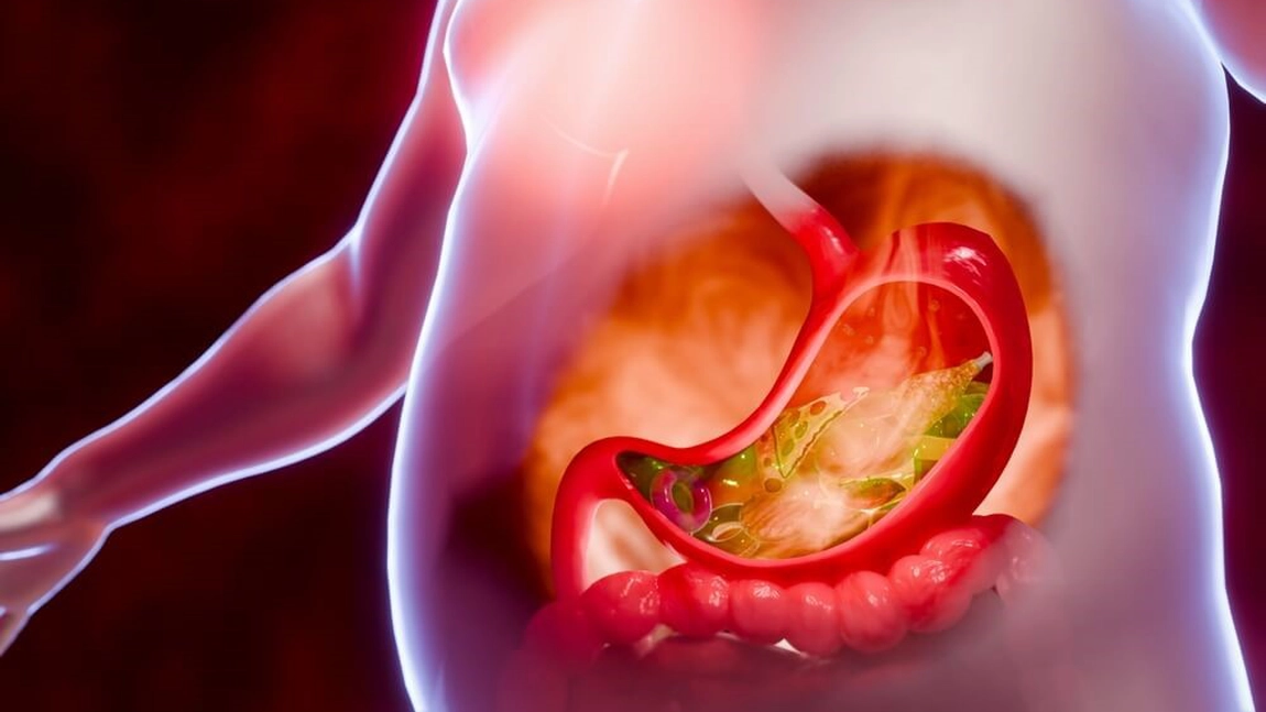 Leacuri bătrânești pentru arsuri de stomac. Iată ce remedii recomandă Dr. Claudia Marin