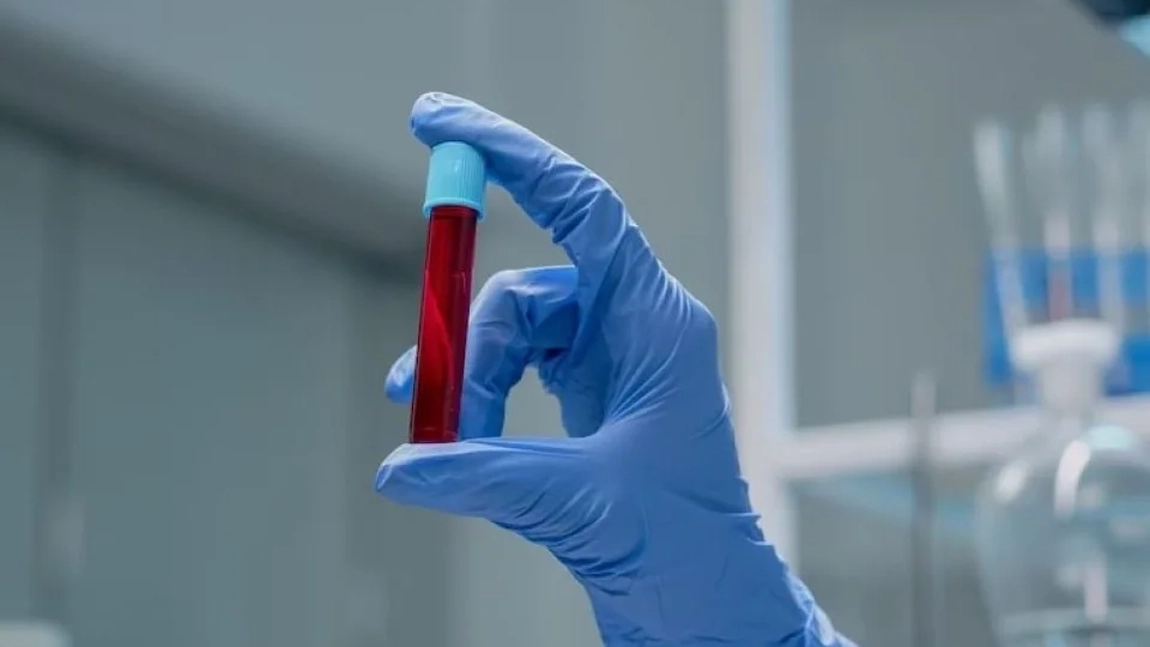 Care sunt valorile normale la globulele roșii? Dr. Oana Cuzino explică tot ce trebuie să știi despre eritrocite!