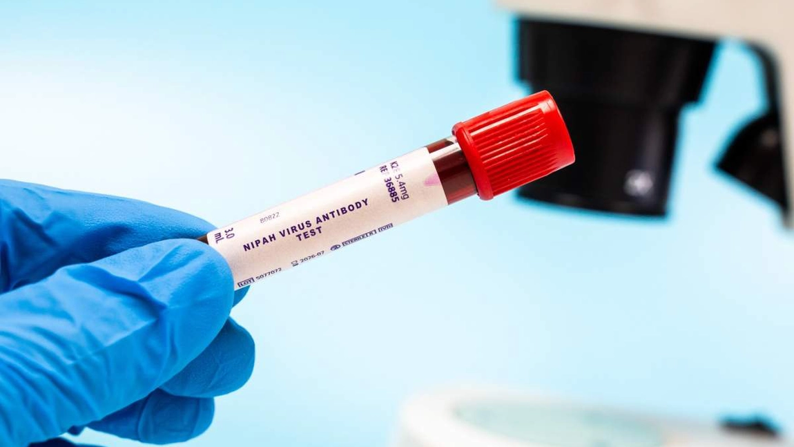 Ce este virusul Nipah și de ce provoacă îngrijorare globală: simptome și alerte în India și UK