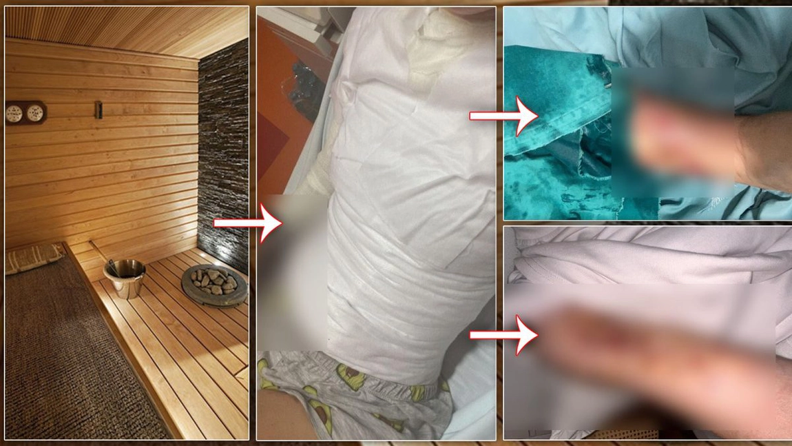 Ana Oprea, victima incidentului de la Hotelul Kronwell, rupe tăcerea! Femeia a fost desfigurată, însă dosarul în care cei vinovați sunt părți se află în „moarte clinică”!