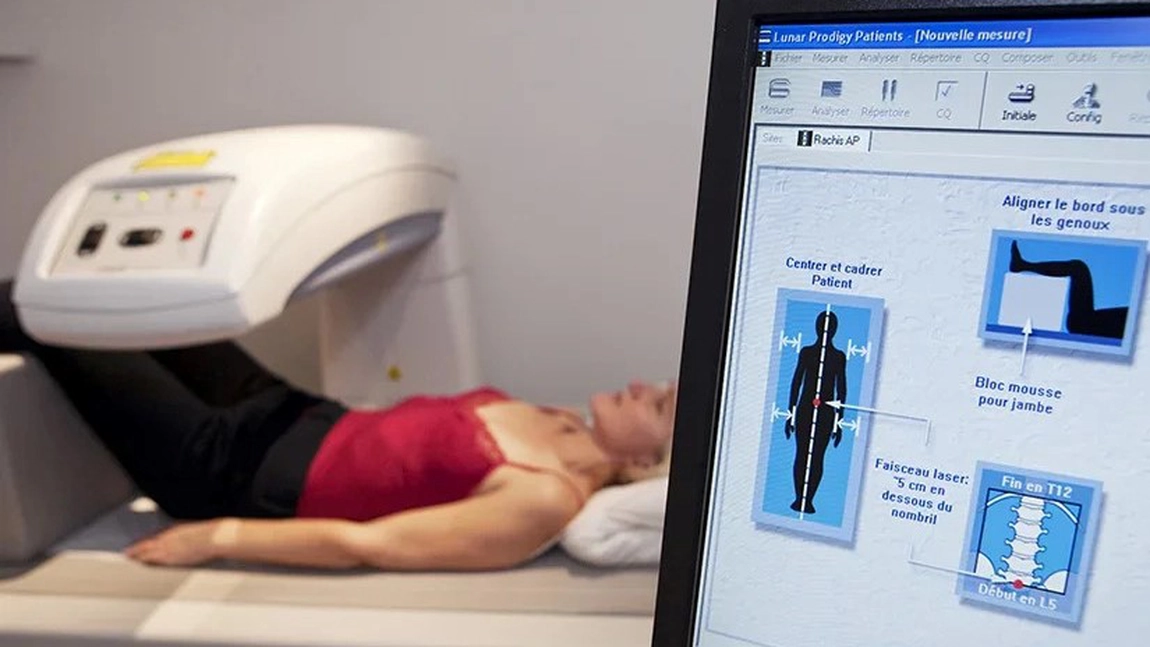 Se poate face un test de osteoporoză cu bilet de trimitere? Iată tot ce trebuie să știi despre acest proces!