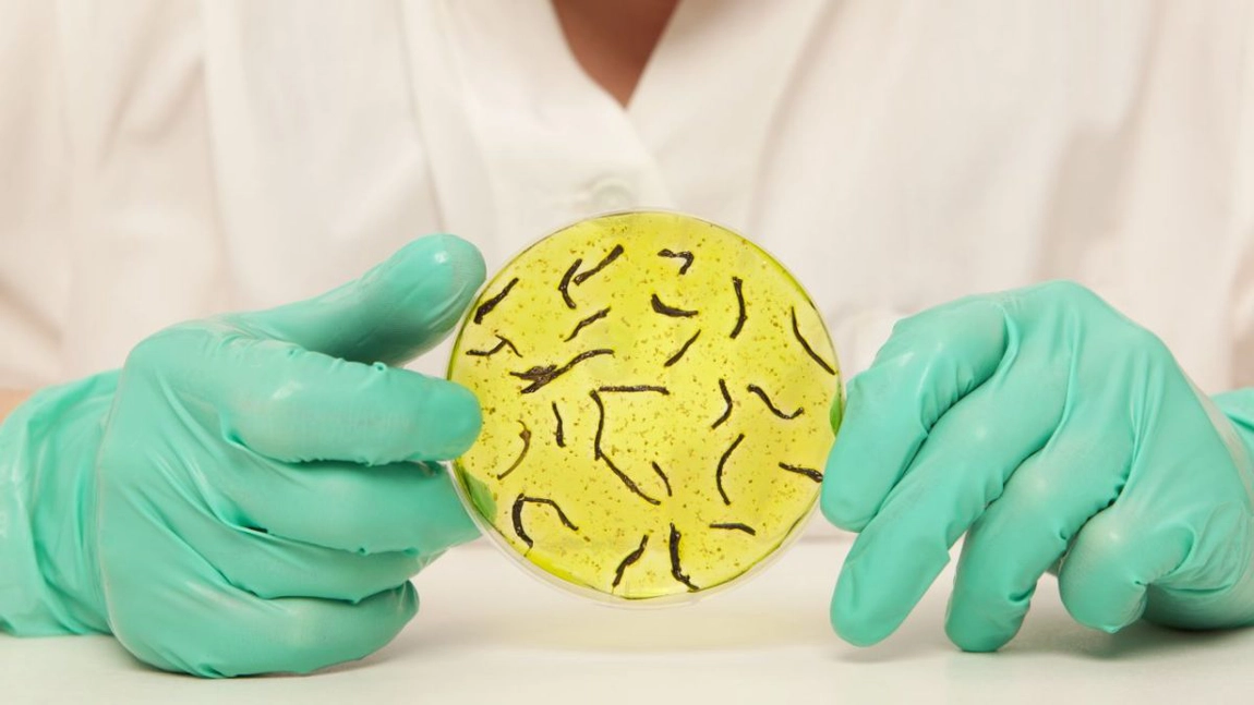 Caz fără precedent în ultimii 125 de ani. Un bărbat a murit de holeră în Marea Britanie