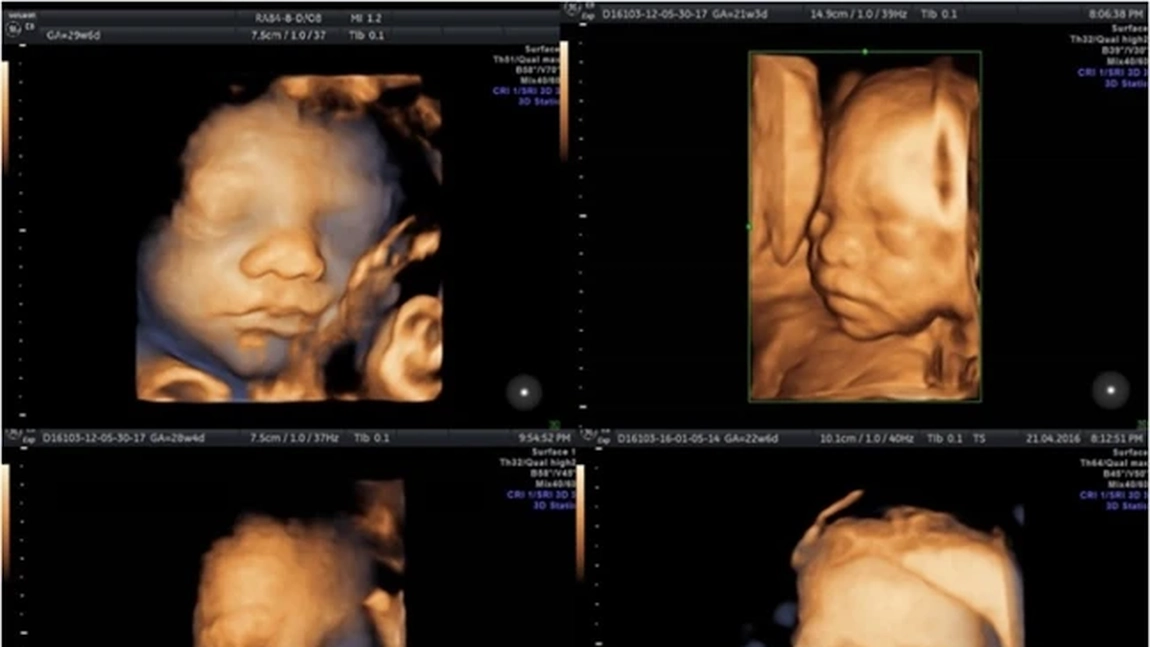 Ce preț are o morfologie fetală în trimestrul 2? Iată ce presupune examinarea, dar și care sunt factorii care influențează costul acesteia!