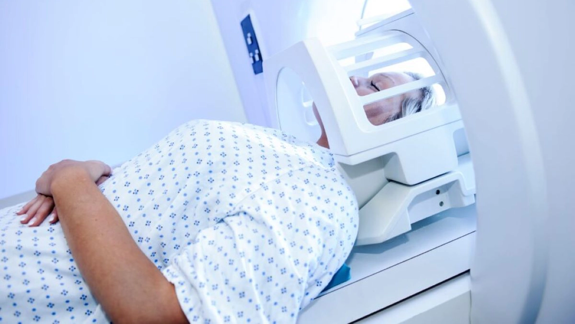 Ce este un RMN cerebral și când este acesta indicat? Iată de ce este important în procesul de diagnosticare!