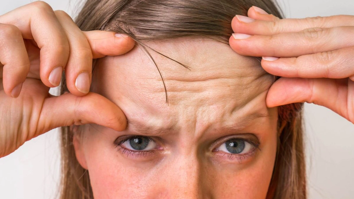 Ce opțiuni de tratament există pentru riduri pe frunte? Dr. Laura Mocanu explică tot ce trebuie să știi!