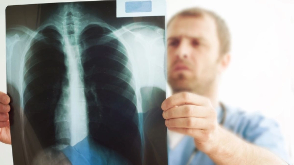 Care sunt simptomele unui tromboembolism pulmonar? Este a treia cauză cardiovasculară de deces!