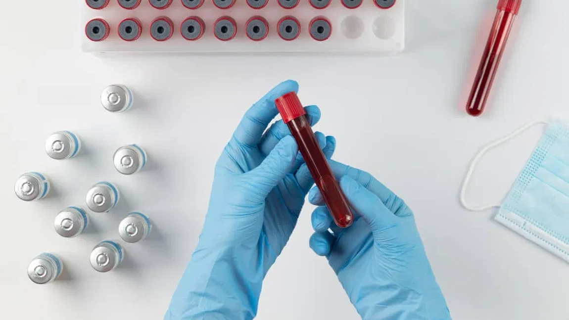 Ce trebuie să știi despre valorile CEA în cancer? Dr. Cătălin Costovici explică ce indică acest marker tumoral!