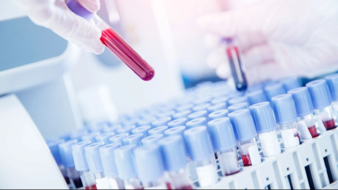 Un VSH mare este un semn sigur de cancer? Iată ce afecțiuni poate indica această analiză!