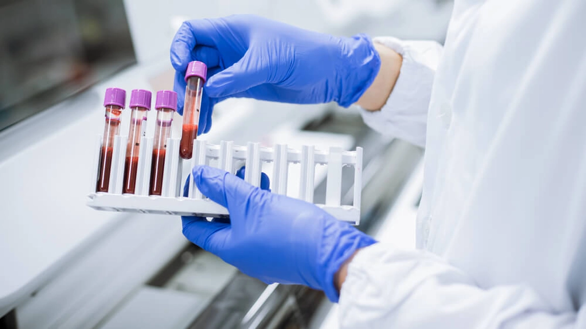 Cancerul e scris în sânge. Cercetătorii au descoperit grupa sanguină cea mai protejată de boală