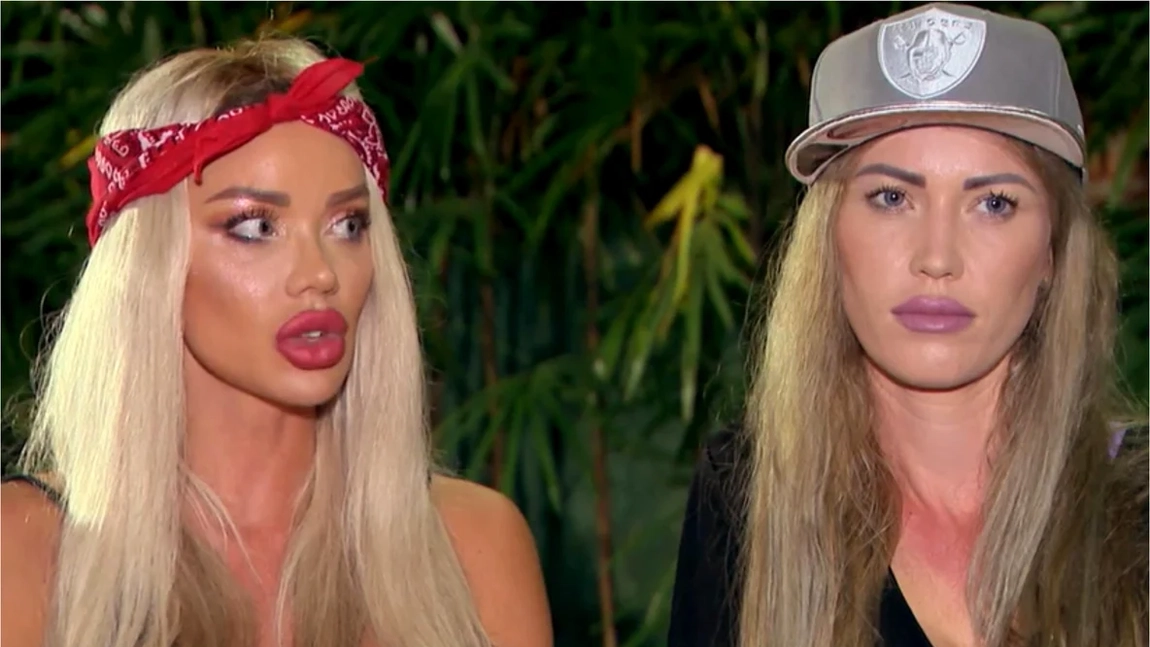 Sora Biancăi Drăgușanu și-a făcut o nouă intervenție estetică! Oana s-a afișat cu capul complet bandajat