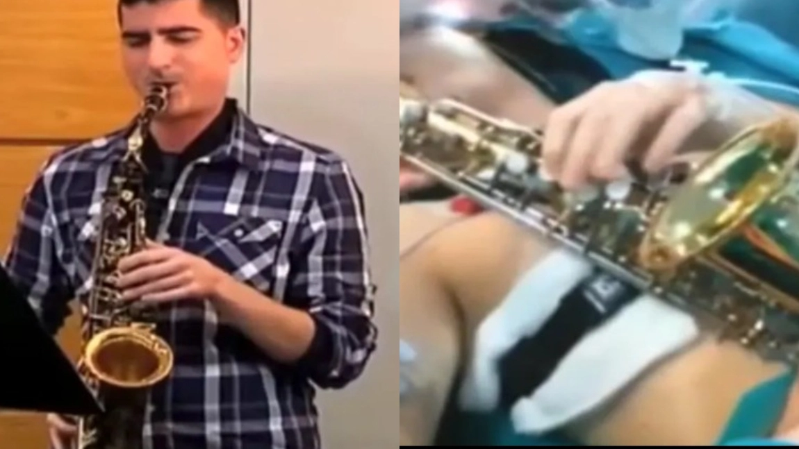 A murit Carlos Aguilera, la doar 38 de ani! Artistul a șocat lumea după ce a cântat la saxofon 12 ore, în timp ce era operat pe creier! 