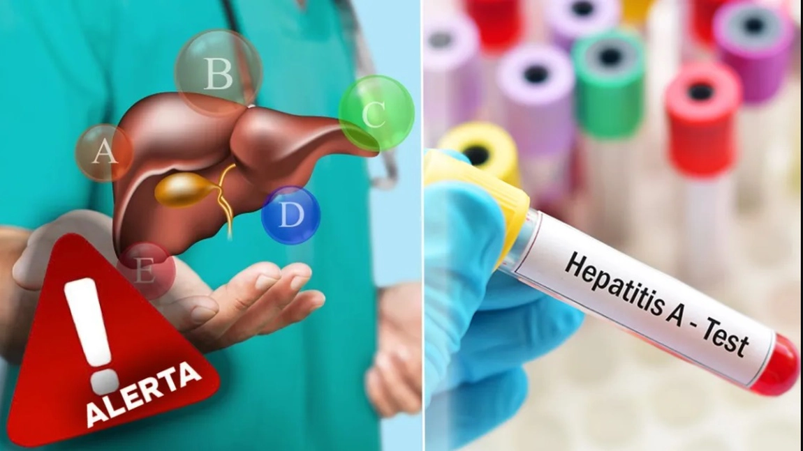 Focar de hepatita A! Cauza bolii, alimente consumate în mod frecvent de români