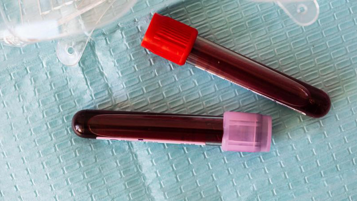 Ce înseamnă când ai un WBC crescut la analize? Când poate deveni o urgență medicală