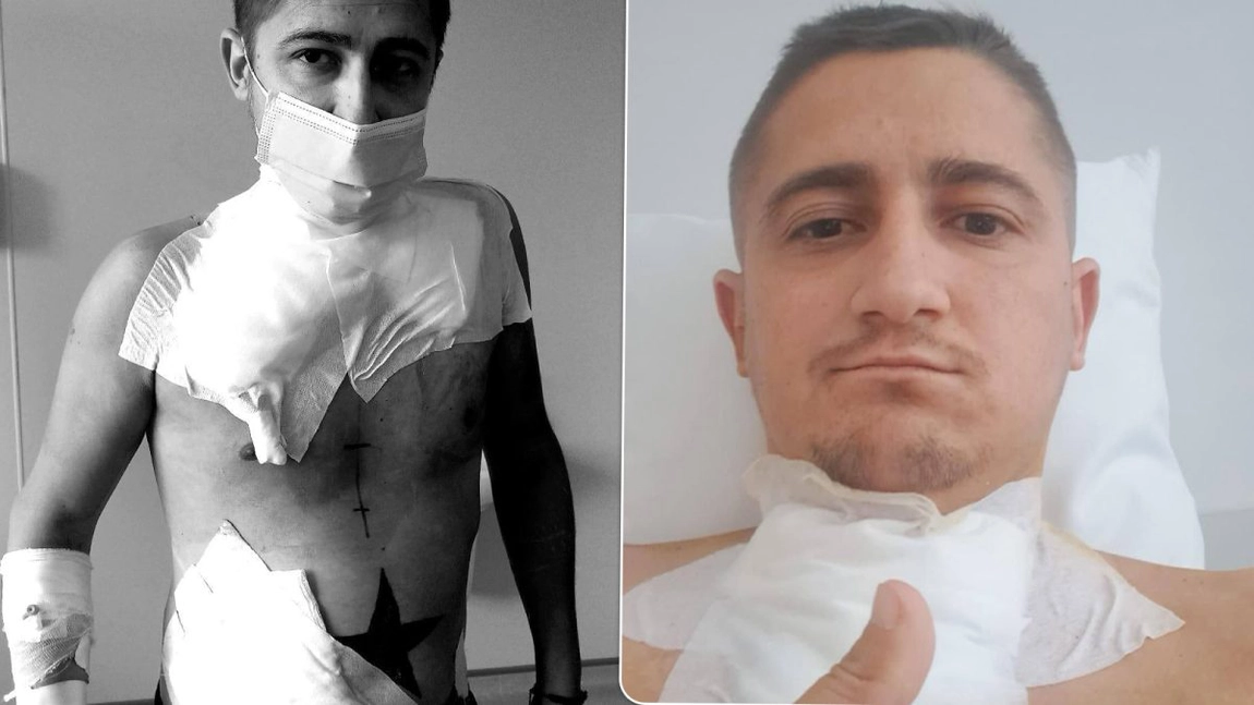 Adrian Oprea, un tânăr cu Lupus, se luptă să ducă o viață normală după ce rinichiul i-a cedat la doar două zile după transplant. „Mi-am pierdut speranța”