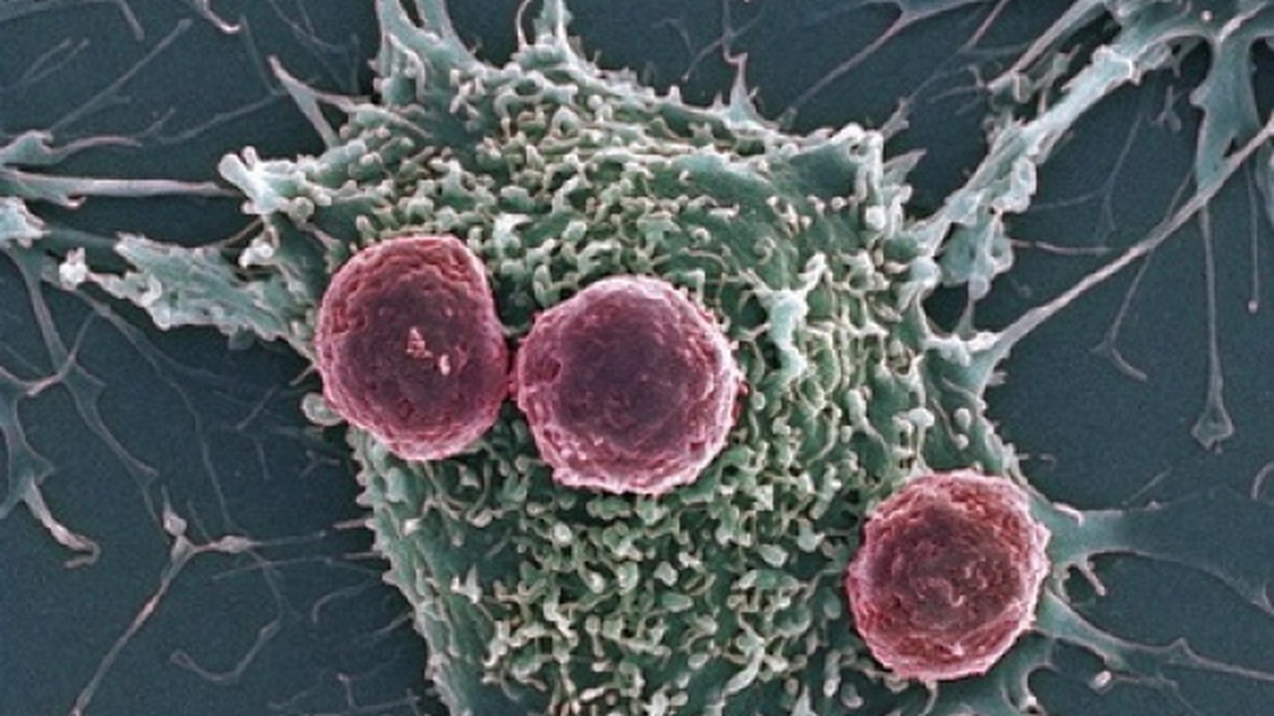 Rolul limfocitelor in organism. Vezi si ce determina cresterea si scaderea limfocitelor