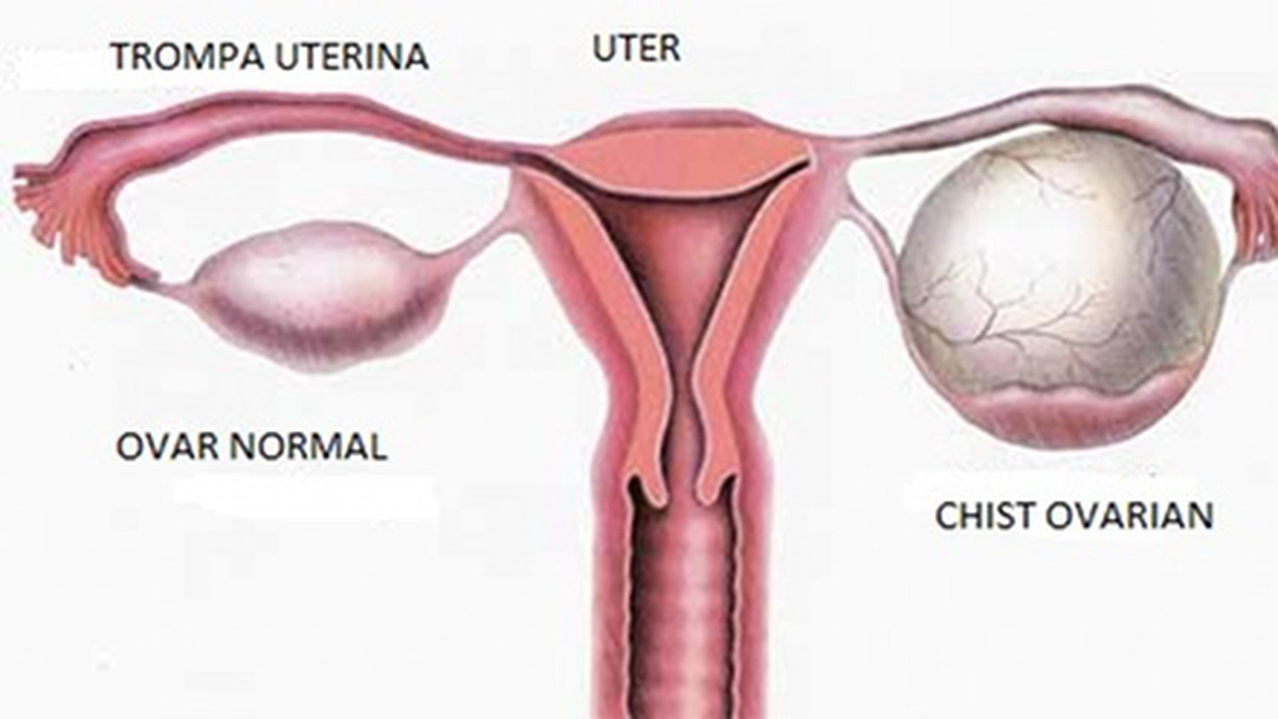 Uleiul care impiedica formarea chisturilor ovariene, bolile de inima si intareste foarte tare sistemul imunitar