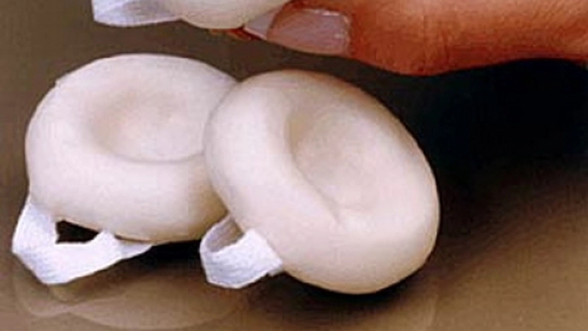 Buretele contraceptiv te fereste de o sarcina nedorita timp de 24 de ore