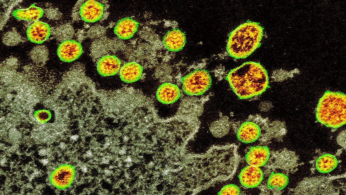 Tipurile de celule umane cele mai vulnerabile la noul coronavirus