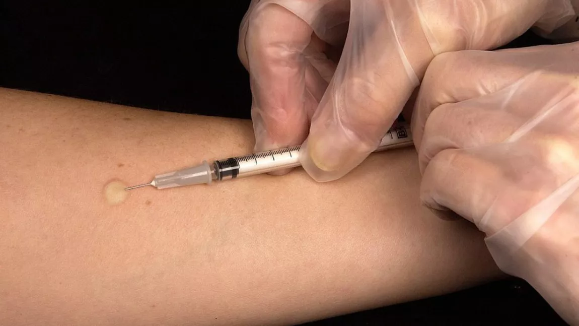 Vaccinul BCG împotriva tuberculozei, un posibil „scut“ pentru personalul din sănătate în lupta împotriva Covid-19