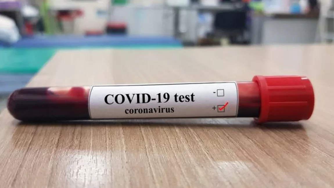 Câte cazuri de COVID-19 au fost înregistrate în ultima zi? Numărul este în scădere - GRAFICE