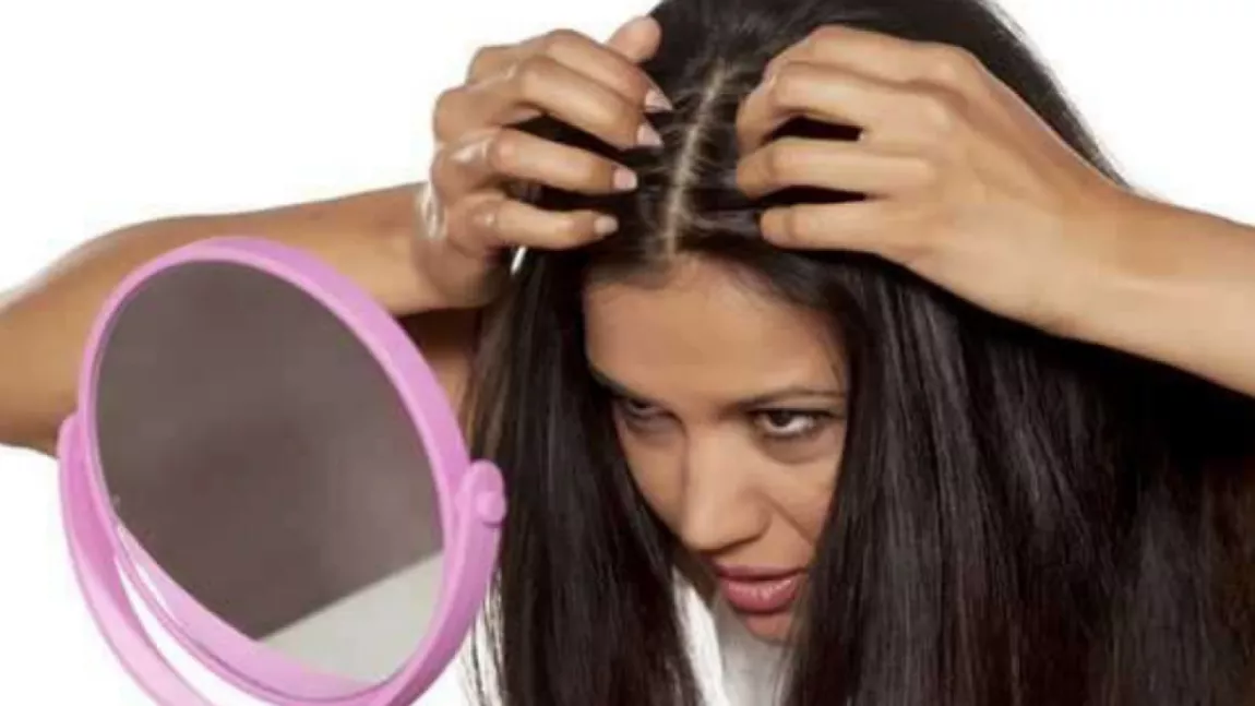 3 sfaturi pentru a-ți trata scalpul iritat cu un ingredient din bucatarie