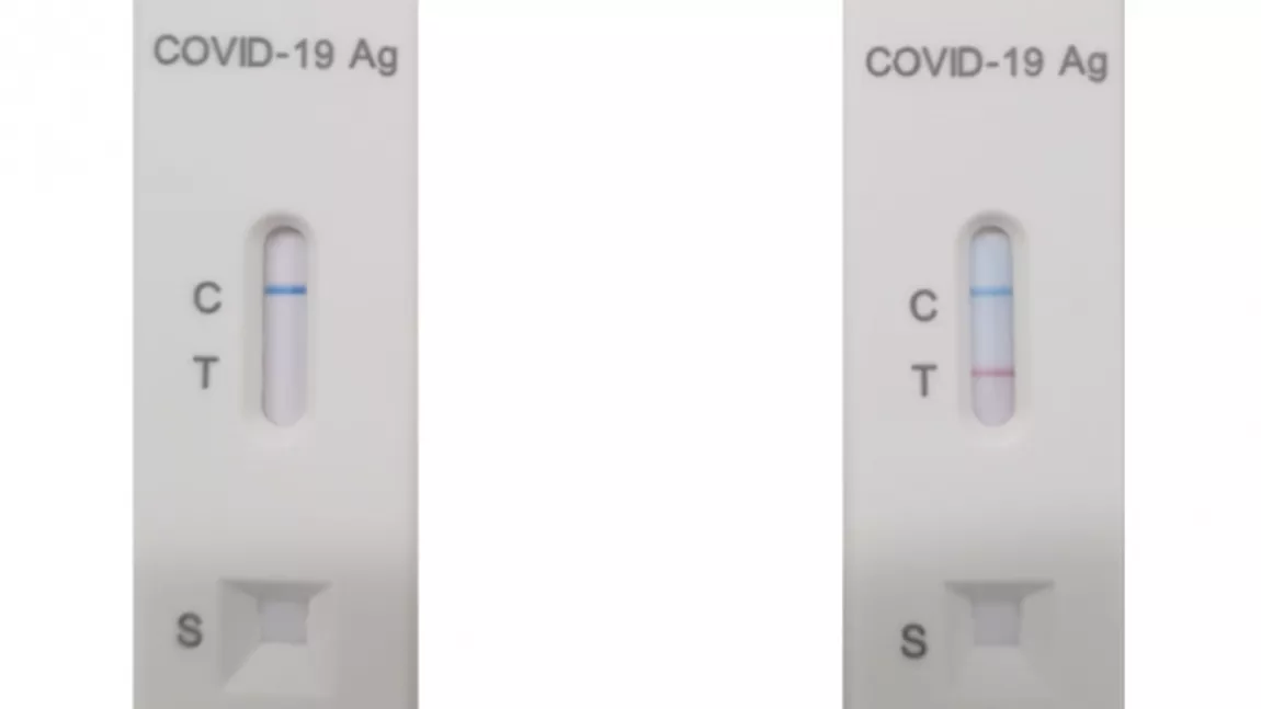 O echipă de cercetători români a realizat un test Covid-19 Antigen. Rezultatul, în 15 minute