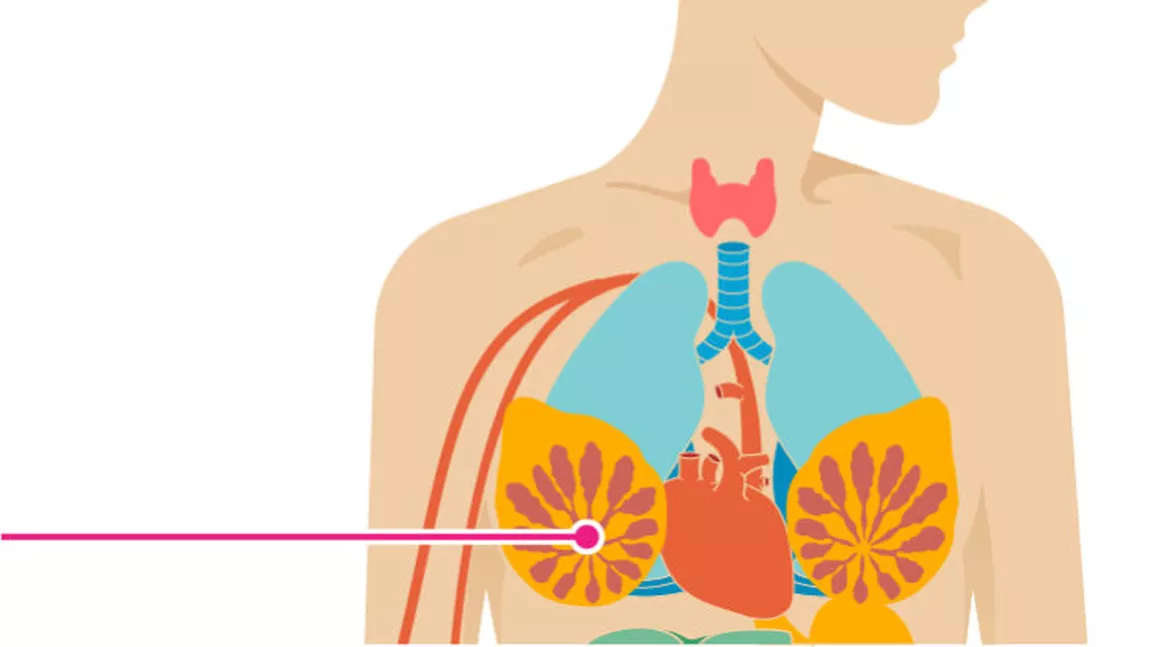 Cele mai cunoscute simptome de cancer la sân