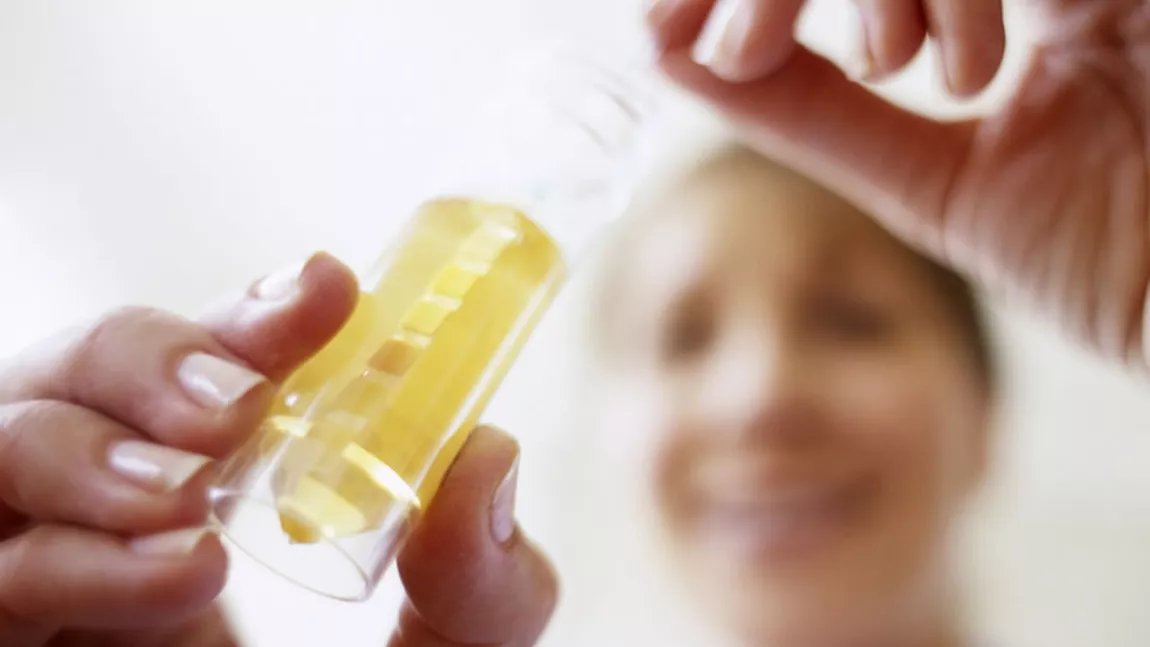 Corpi cetonici în urină: Care este legătura cu diabetul și cât de periculoși pot fi