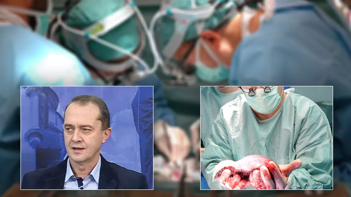 Peste 30 de pacienți sunt pe lista de așteptare pentru transplant hepatic, la Iași! Familia posibililor donatori refuză prelevarea organelor. Prof. dr. Cristian Lupașcu: ”De multe ori, pacienții de pe liste mor în timp ce așteaptă un ficat”