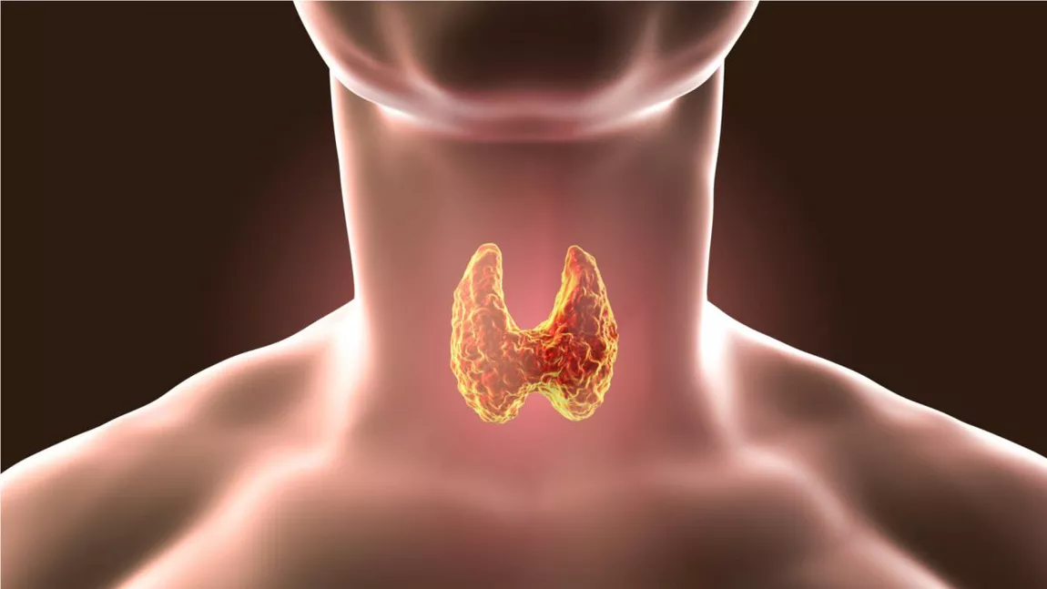 Hipertiroidism, alimente interzise. Noduli tiroidieni: cauze și simptome