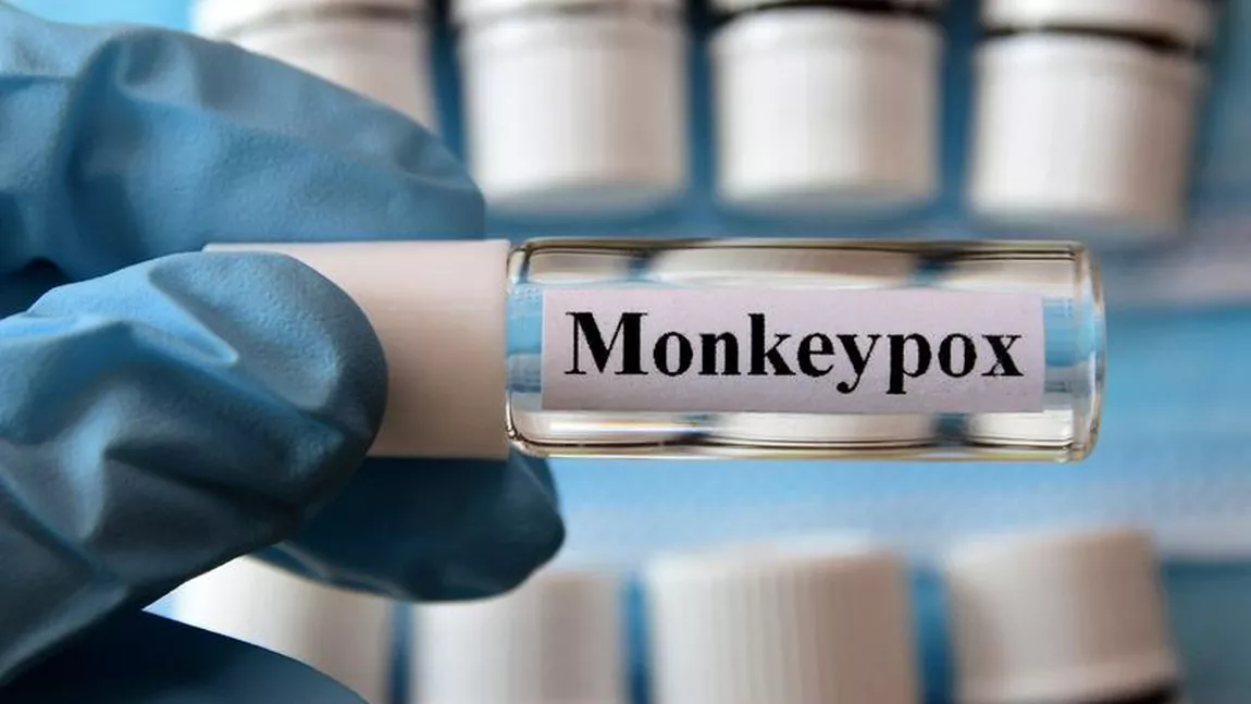 Trei noi cazuri de variola maimuţei, în România. OMS a publicat un prim profil al pacienţilor
