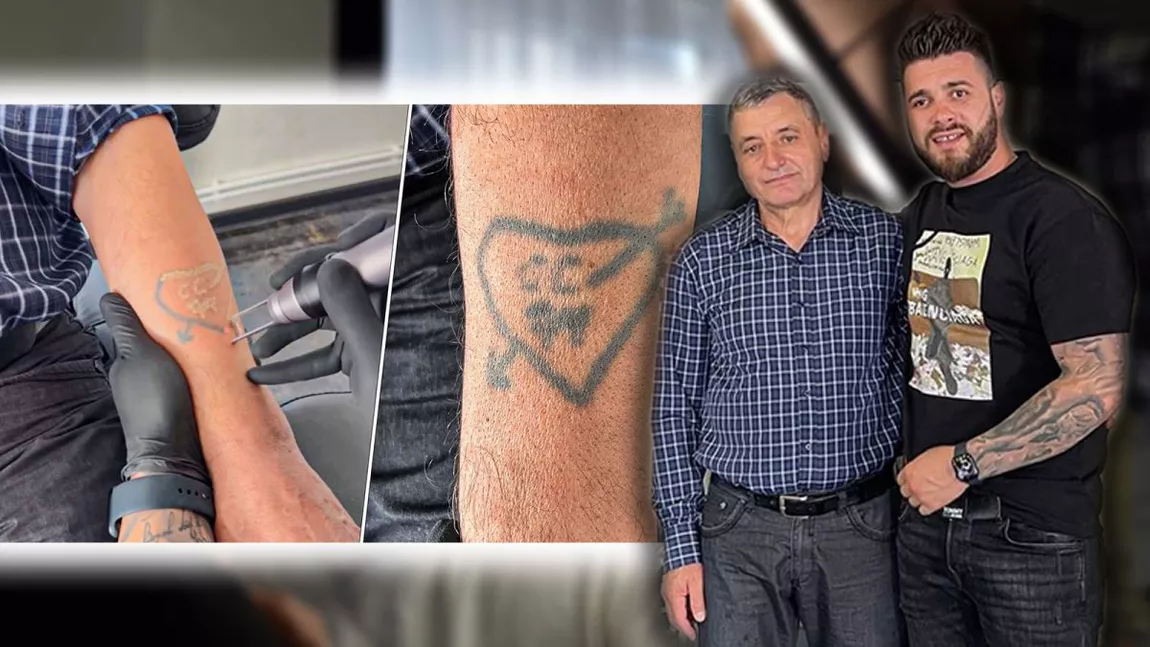 Tatuaj vechi de 50 de ani, îndepărtat la un salon din Iași! Care este povestea din spatele „greșelii