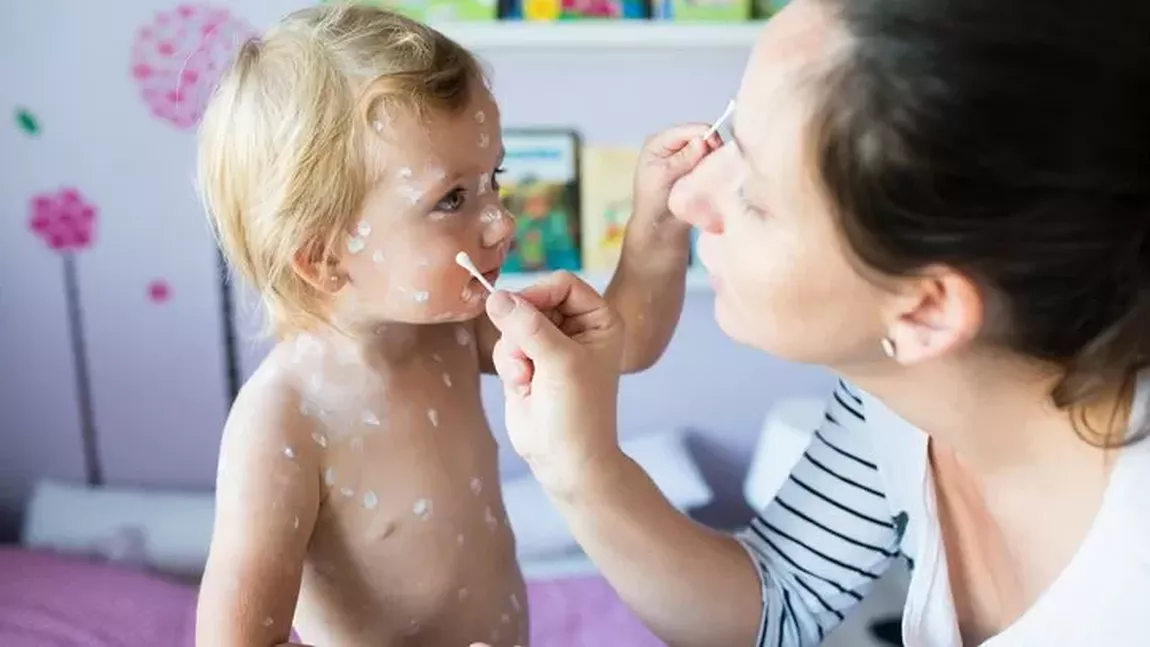 Boala contagioasă în rândul copiilor. Pot avea efecte devastatoare!