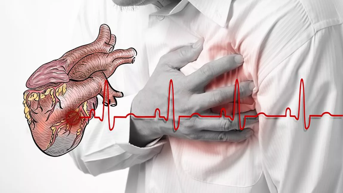 Cât trăiești după infarct? Iată ce spun specialiștii