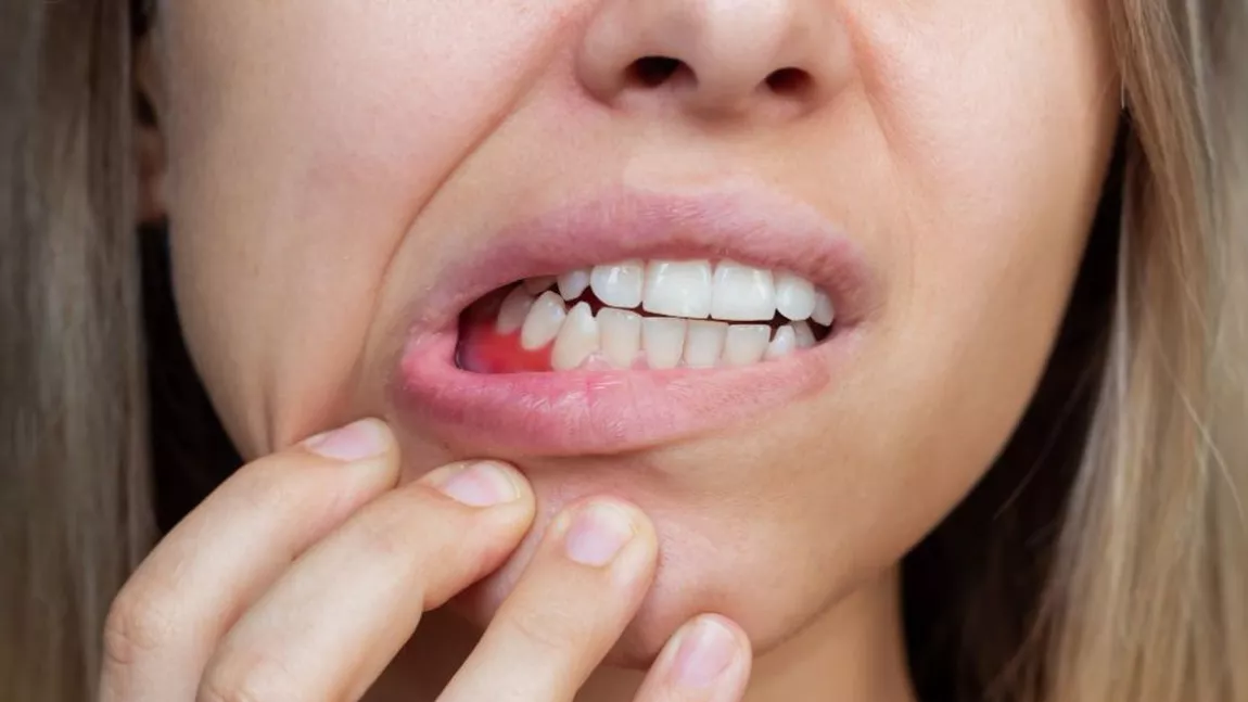 Cum arată harta dinților. La ce se referă aceasta și de ce fiecare pacient trebuie să o aibă?