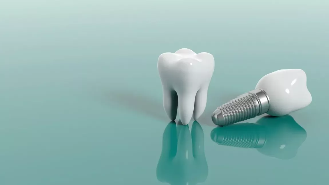 Poți muri de la un implant dentar? Care sunt riscurile asociate