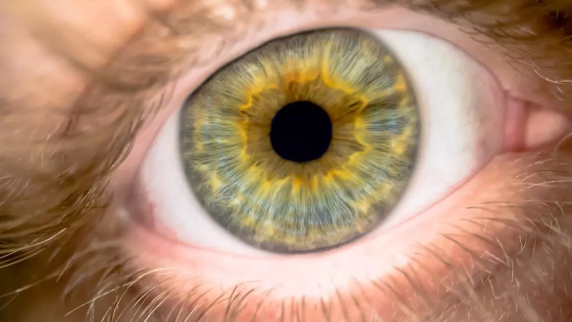 Procedura virală de schimbare a culorii ochilor poate duce la orbire