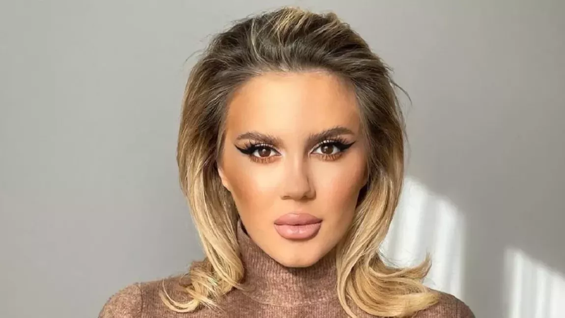 Imagini șocante cu Emily Burghelea! Influencerița s-a afișat cu vânătâi și ochiul umflat. „E un miracol că am rămas în viață”