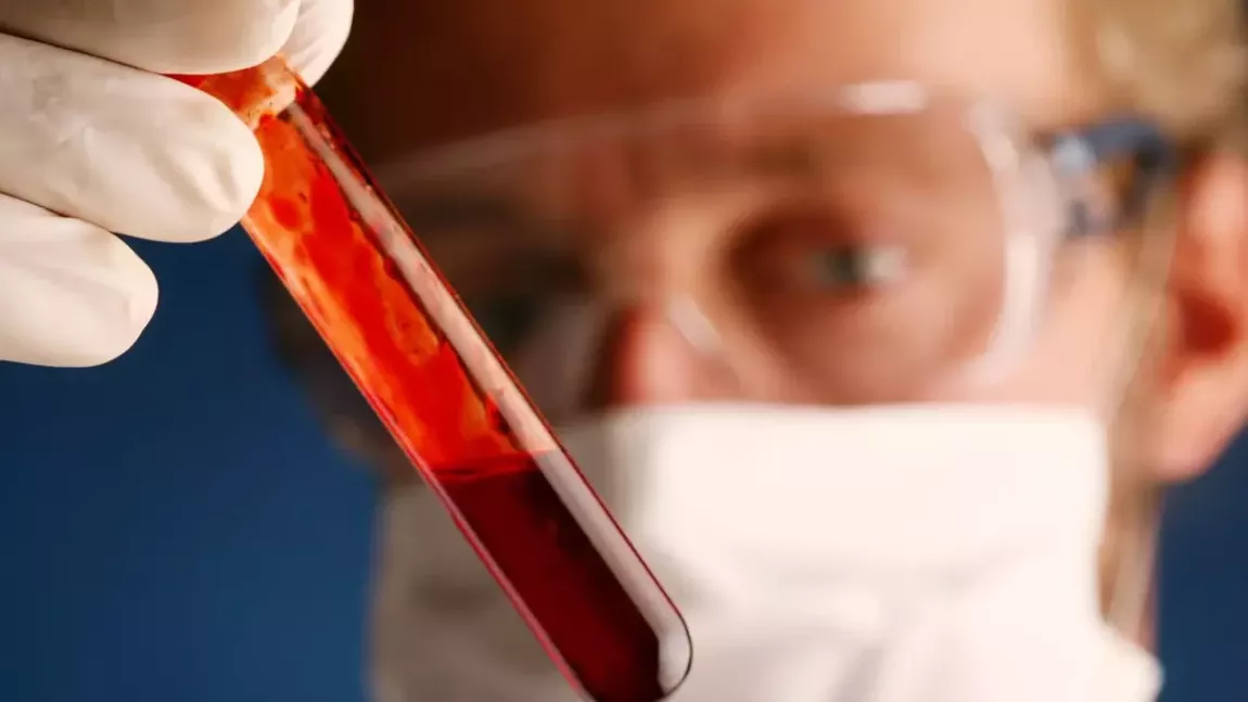 Test de sânge promiţător pentru depistarea cancerului de colon. Ce spun medicii